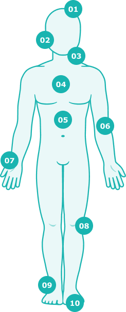 Grafismo cuerpo humano con numeración de problemas que soluciona la fisioterapia